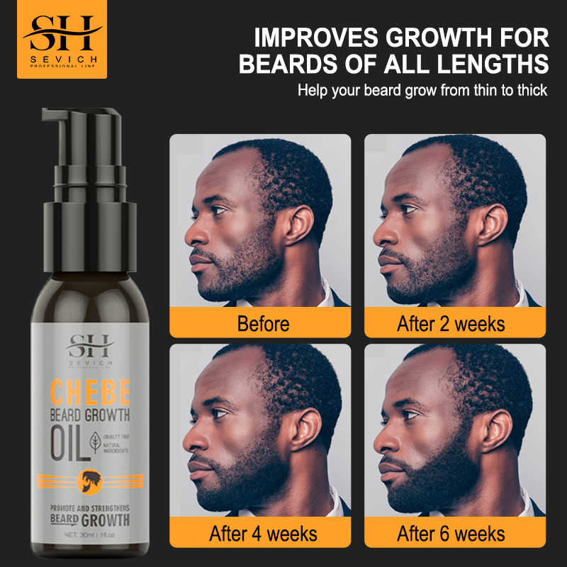 Caffeine Hair Serum - Sevich Men Beard Growth Essential Chebe