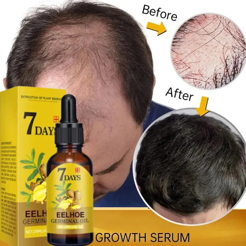 Caffeine Hair Serum - 7 Day Fast Hair Growth Oil
