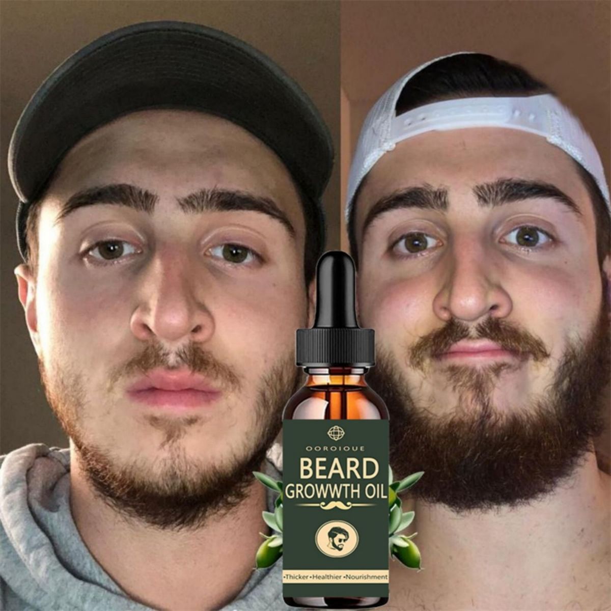 Fast Beard Growth Oil Beard Oi - Caffeine Hair Serum 리뷰 및 가격