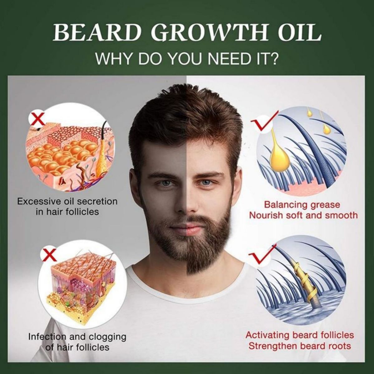 Fast Beard Growth Oil Beard Oi - Caffeine Hair Serum 리뷰 및 가격