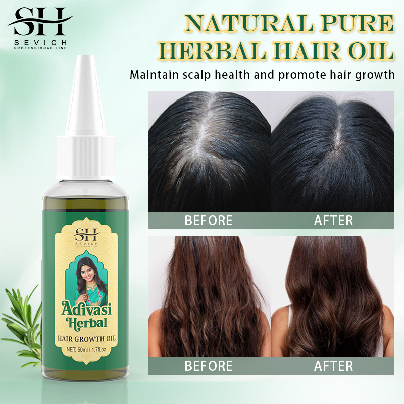 Ayurvedic Hair Growth Oil Adiv - Caffeine Hair Serum 리뷰 및 가격