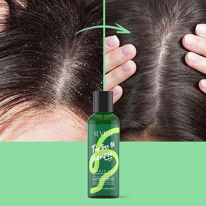 Tea Tree Essence Shampoo Hair  - Hair Care Conditioner 리뷰 및 가격