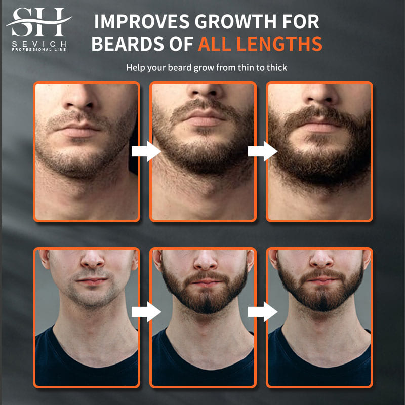Sevich Men Beard Growth Essent - Caffeine Hair Serum 리뷰 및 가격