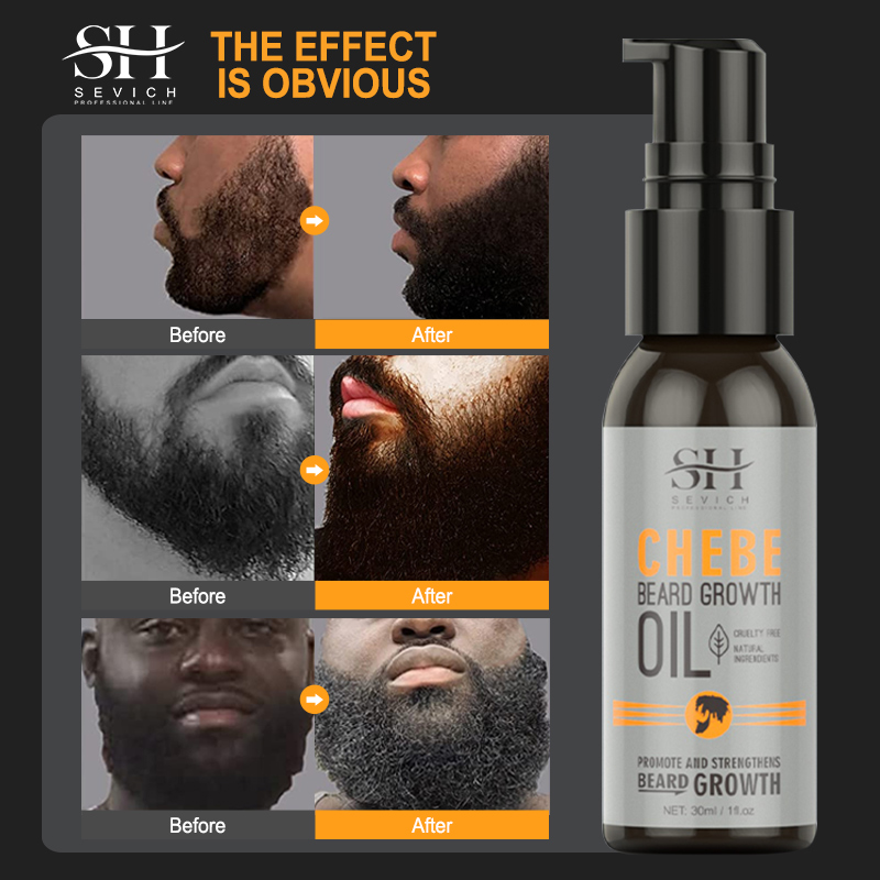 Sevich Men Beard Growth Essent - Caffeine Hair Serum 리뷰 및 가격