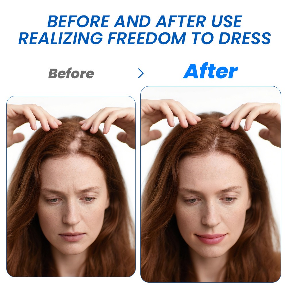 Alopecia Hair Growth Spray Sop - Hair Care For Hair Growth 리뷰 및 가격
