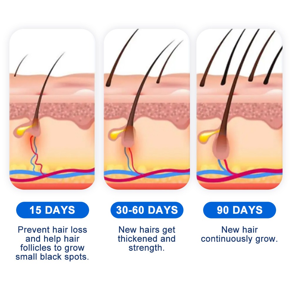 Alopecia Hair Growth Spray Sop - Hair Care For Hair Growth 리뷰 및 가격