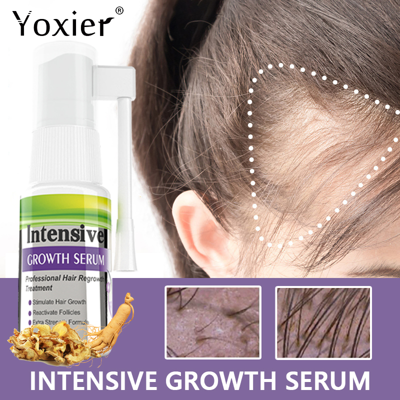 Intensive Growth Serum Prevent - Hair Care For Hair Growth 리뷰 및 가격