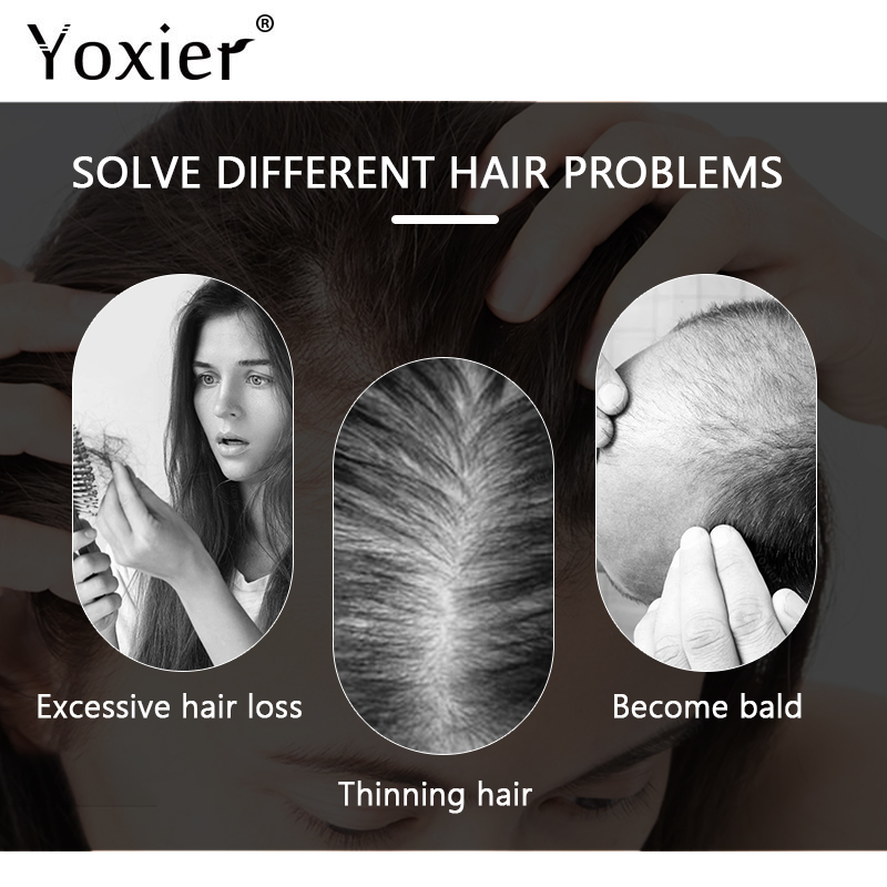 Intensive Growth Serum Prevent - Hair Care For Hair Growth 리뷰 및 가격