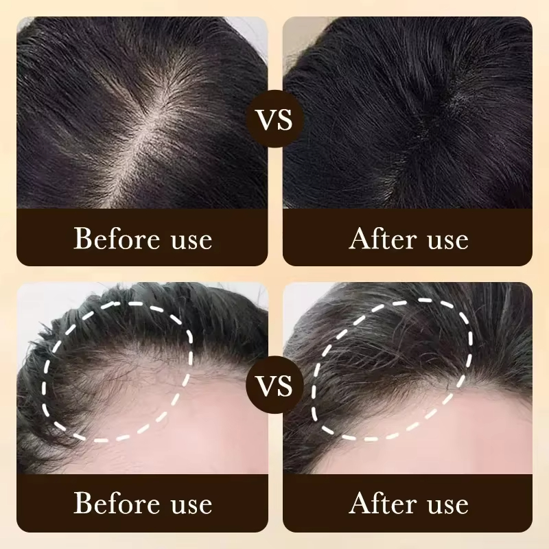 One-stop hair care: Solve basi - Hair Care Basic 리뷰 및 가격