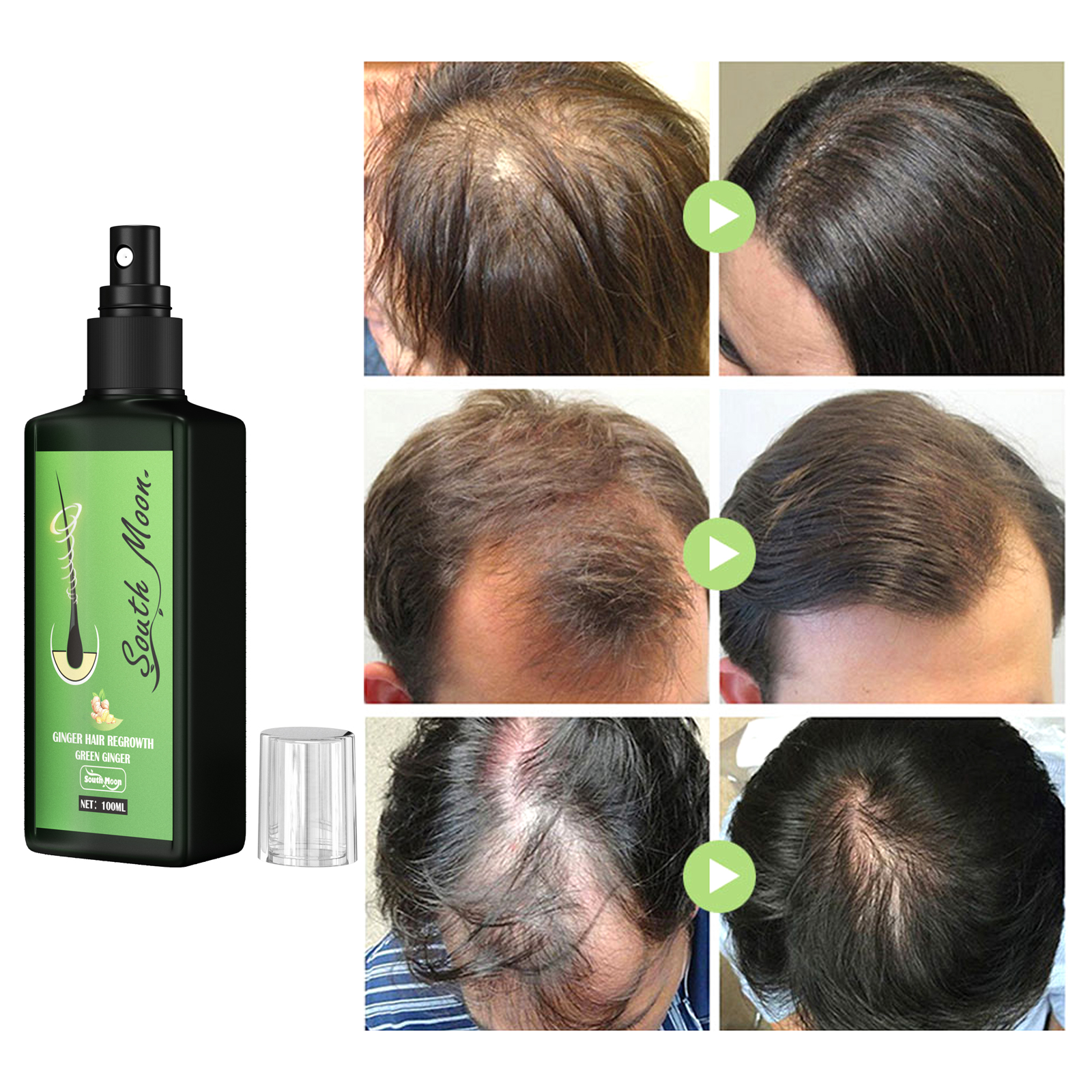Ginger Hair Density Serum Spra - Hair Care For Hair Fall 리뷰 및 가격