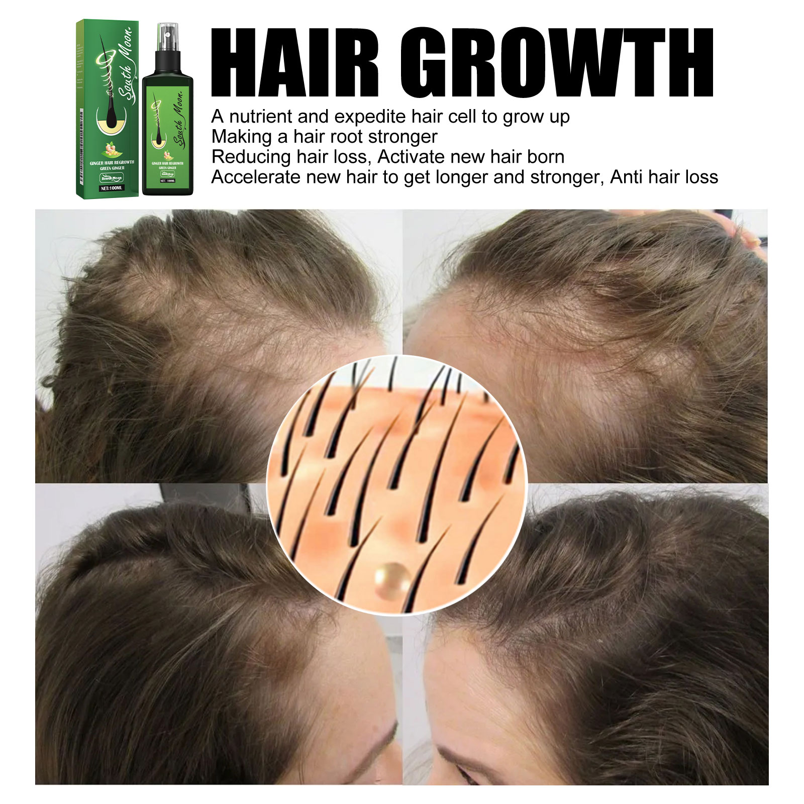 Ginger Hair Density Serum Spra - Hair Care For Hair Fall 리뷰 및 가격