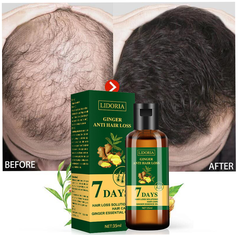 Ginger Hair Growth Essential O - Caffeine Hair Serum 리뷰 및 가격