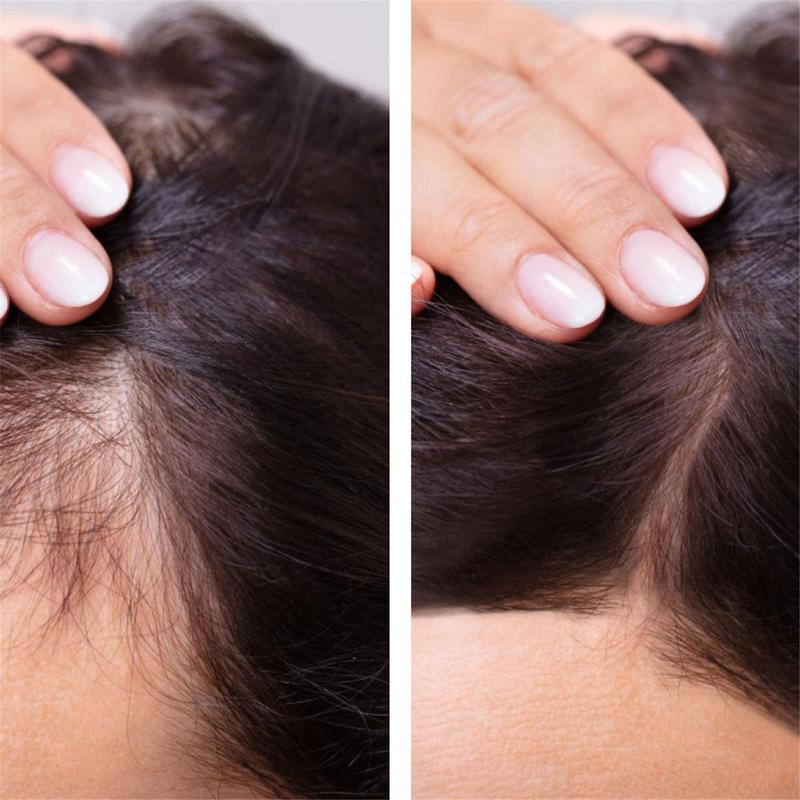 Ginger Hair Growth Essential O - Caffeine Hair Serum 리뷰 및 가격