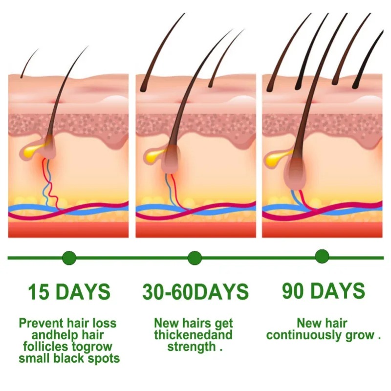 Hair Growth Serum Fast Growing - Caffeine Hair Serum 리뷰 및 가격