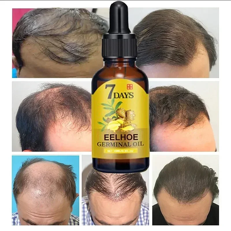 7 Day Fast Hair Growth Oil Gin - Caffeine Hair Serum 리뷰 및 가격