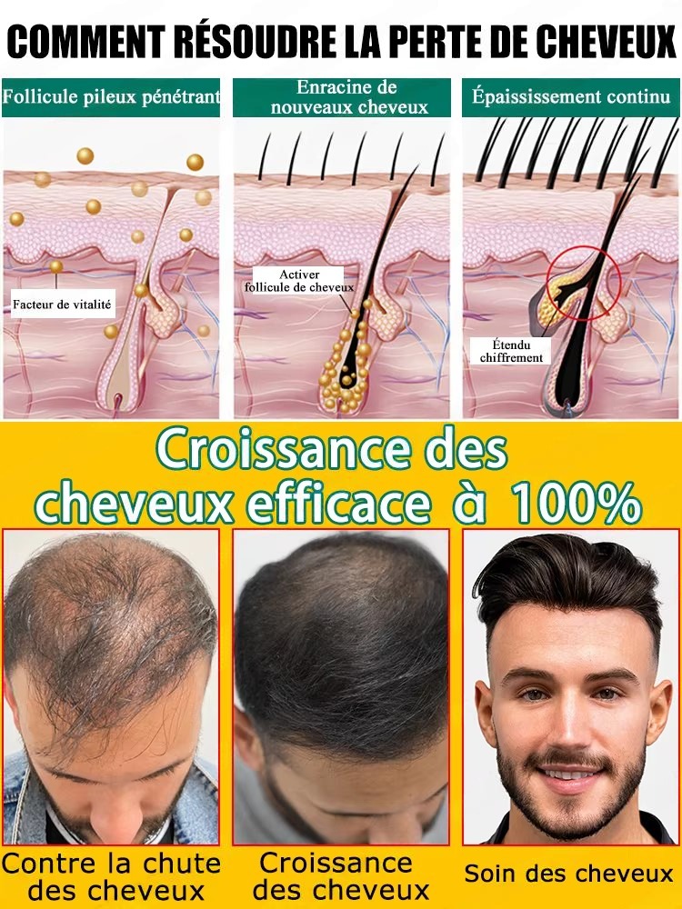 Anti Hair Loss Growth Serum, R - Hair Care For Hair Fall 리뷰 및 가격