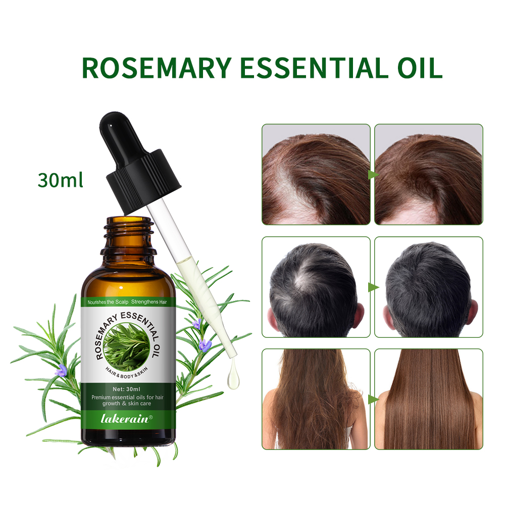 30ML Rosemary Hair Care Oil An - Hair Care For Hair Fall 리뷰 및 가격