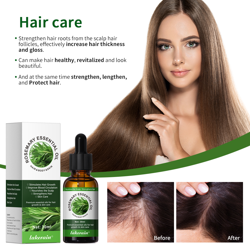 30ML Rosemary Hair Care Oil An - Hair Care For Hair Fall 리뷰 및 가격
