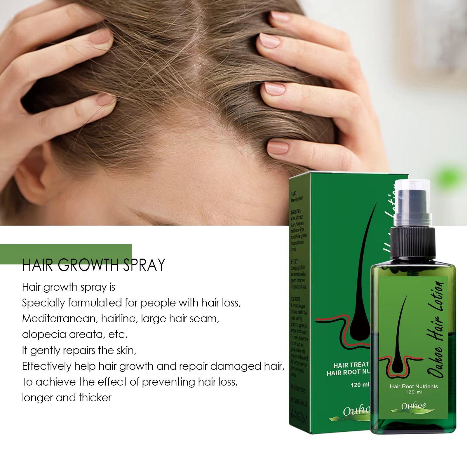 Hair Growth Spray Anti Hair Lo - Hair Care For Hair Loss 리뷰 및 가격