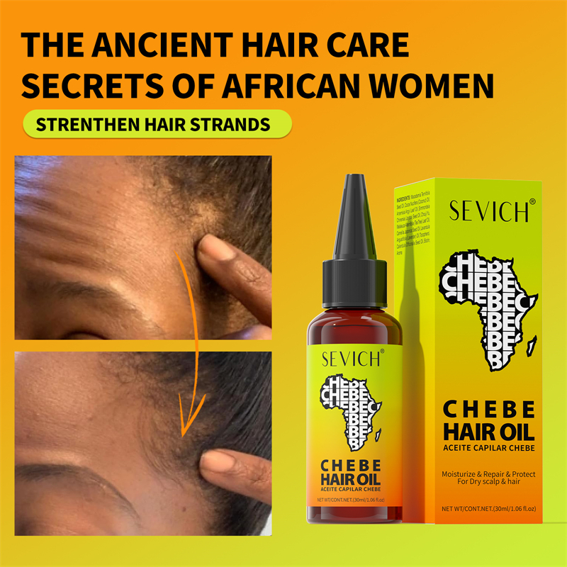 Chebe Fast Hair Growth Oil Afr - Caffeine Hair Serum 리뷰 및 가격