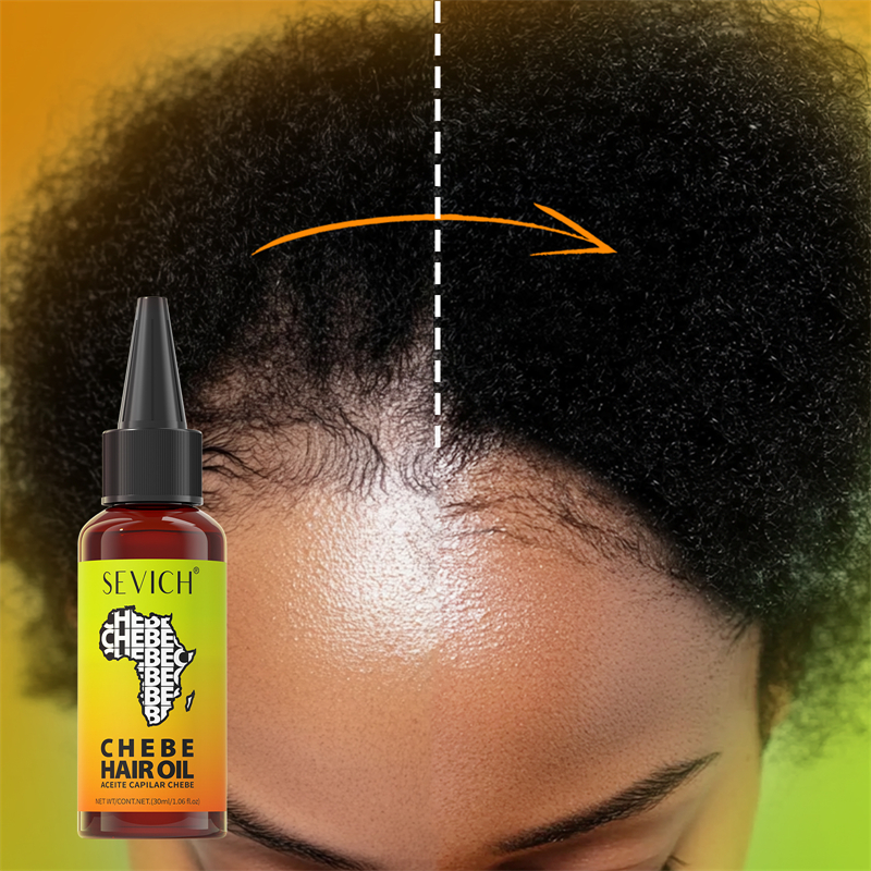 Chebe Fast Hair Growth Oil Afr - Caffeine Hair Serum 리뷰 및 가격