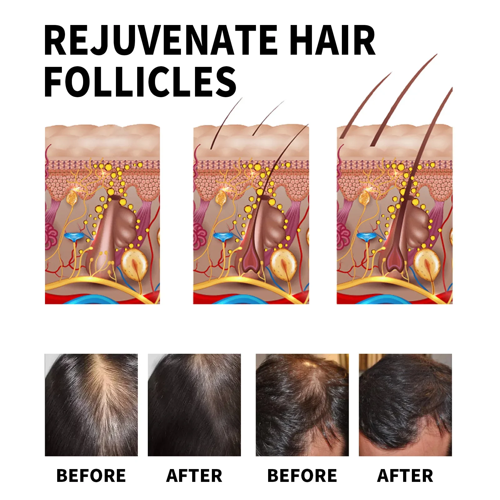 Ginger Hair Growth Products Fa - Caffeine Hair Serum 리뷰 및 가격