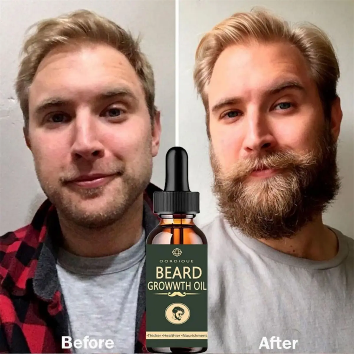 Fast Beard Growth Oil Beard Oi - Caffeine Hair Serum 리뷰 및 가격