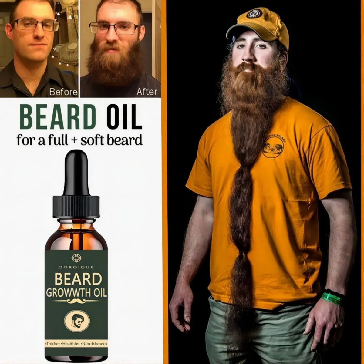 Fast Beard Growth Oil Beard Oi - Caffeine Hair Serum 리뷰 및 가격