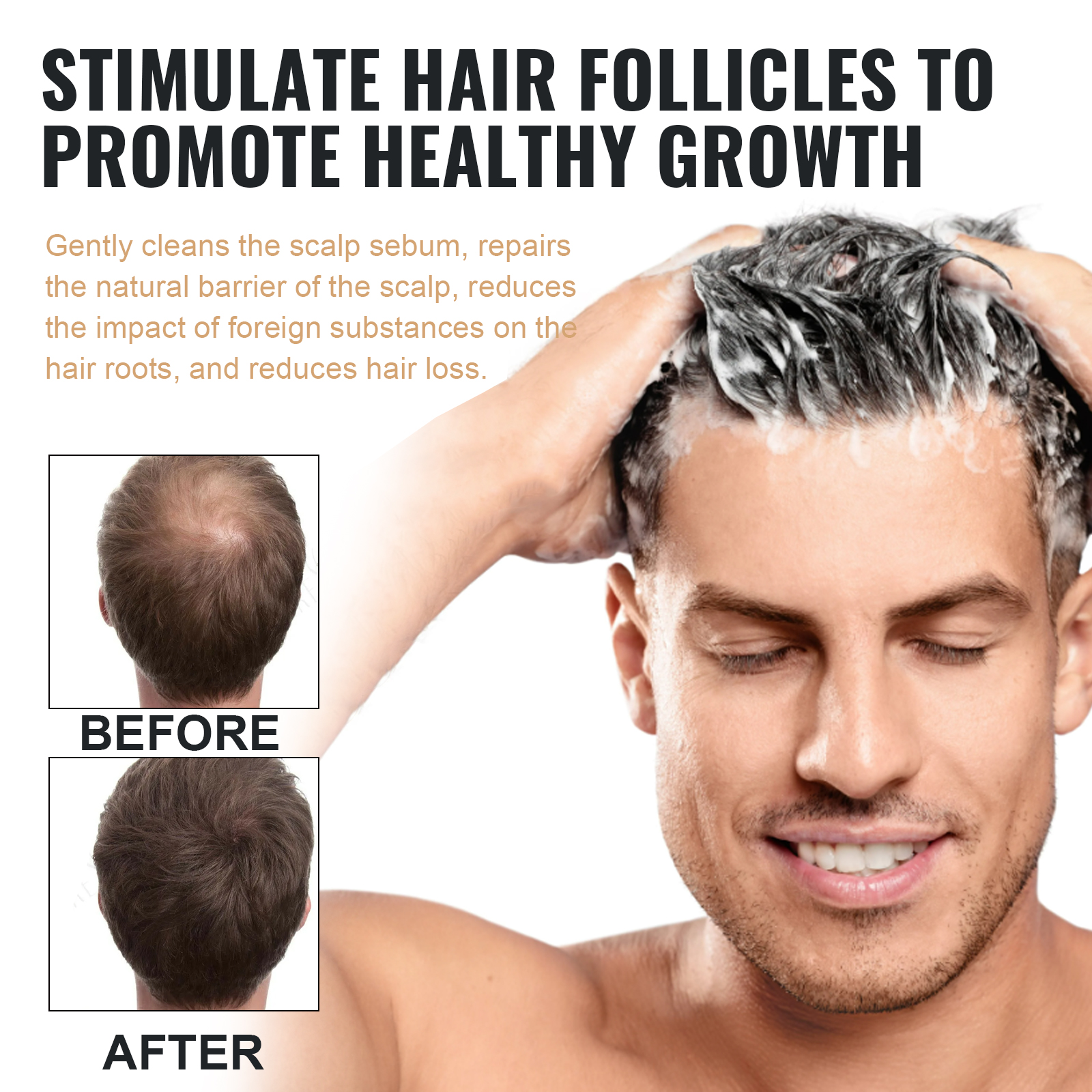 EELHOE 100ml Dense Hair Shampo - Hair Care For Hair Fall 리뷰 및 가격