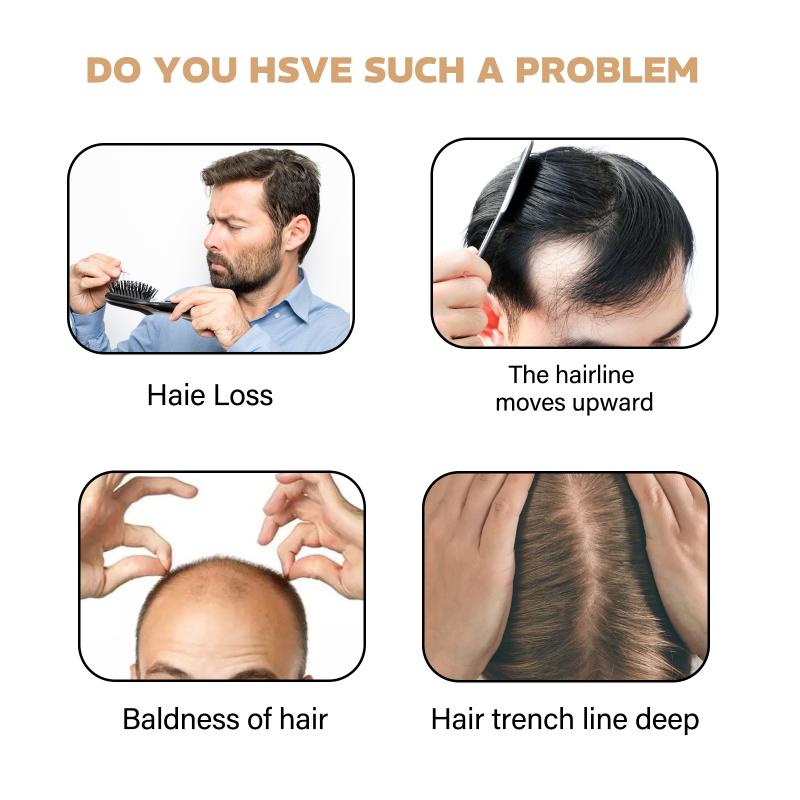 East Moon Hair Thickening Sham - Hair Care For Hair Fall 리뷰 및 가격