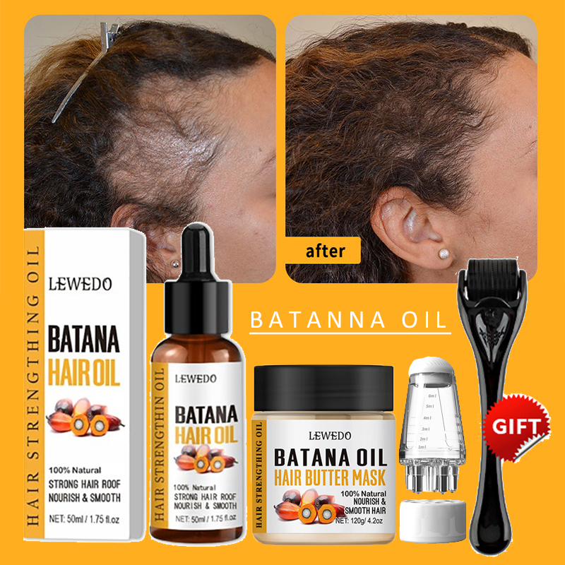 Batana Oil Hair Growth Kit Tra - Hair Care Dupes 리뷰 및 가격