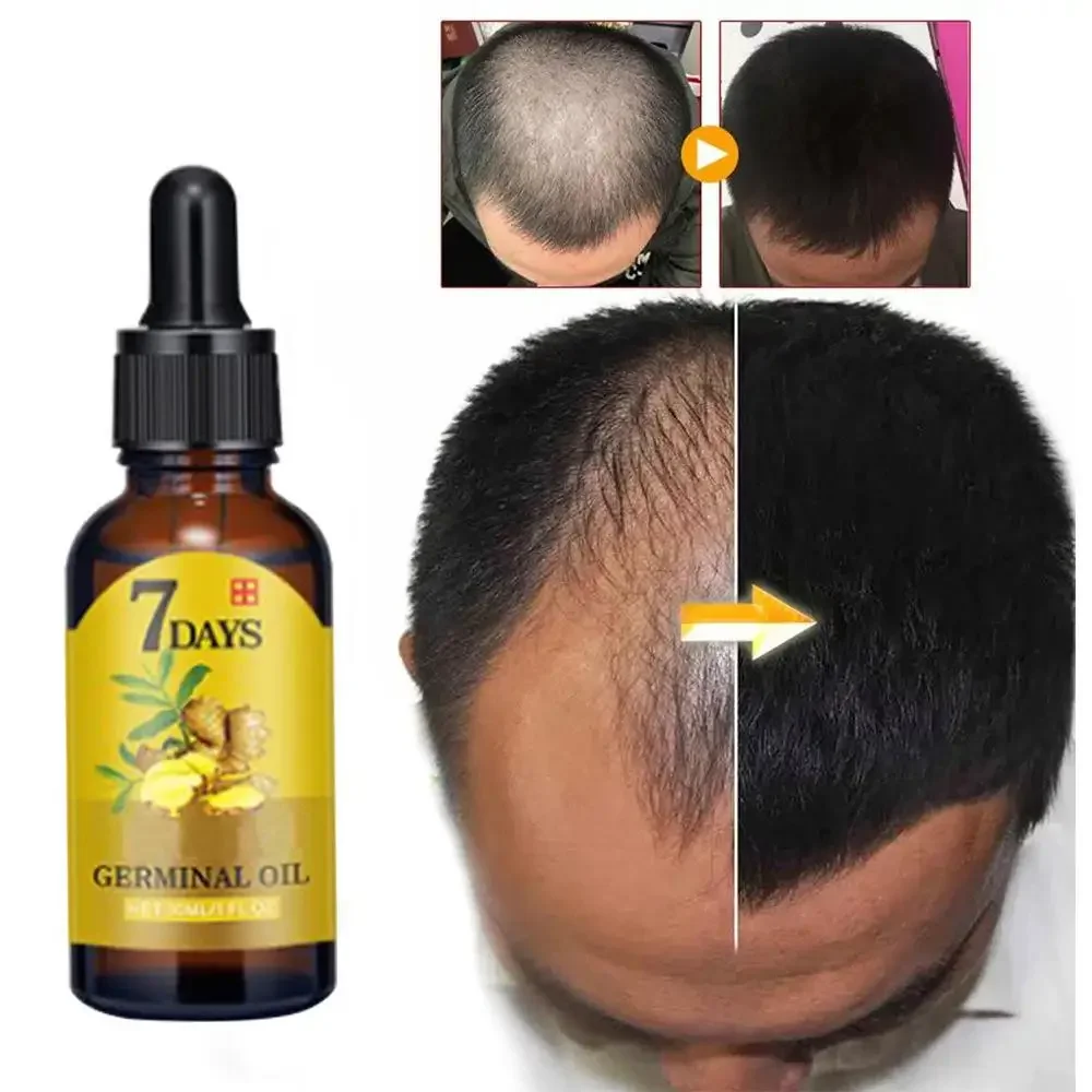 Hair Growth Ginger Fast Growin - Caffeine Hair Serum 리뷰 및 가격