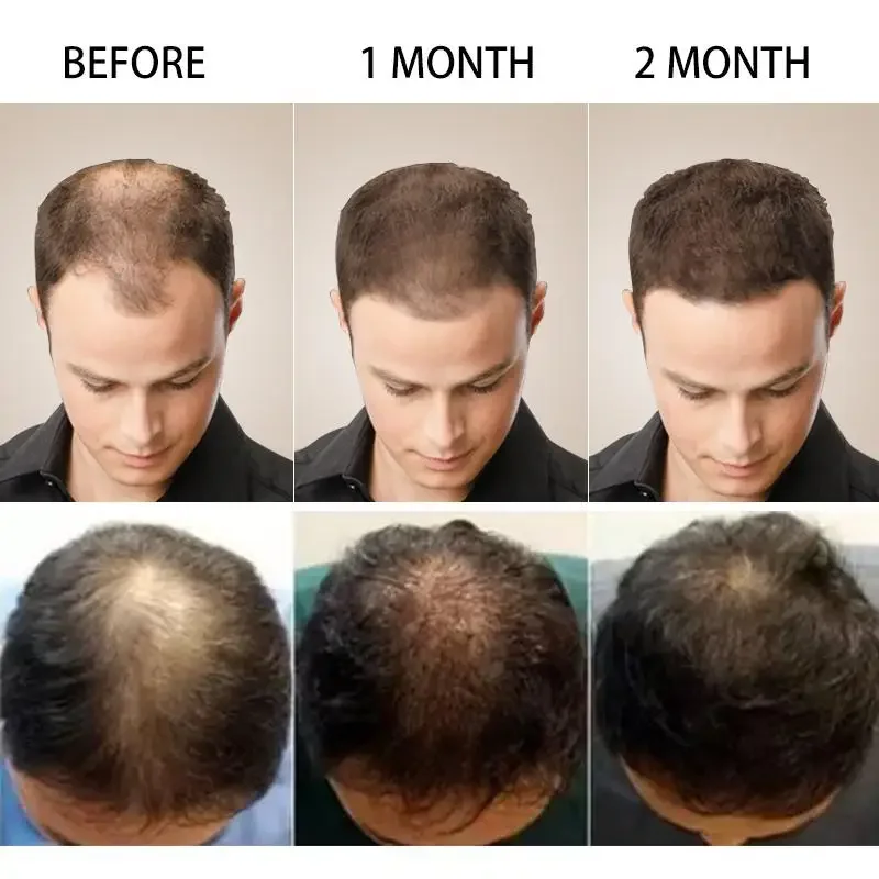 Hair Growth Ginger Fast Growin - Caffeine Hair Serum 리뷰 및 가격