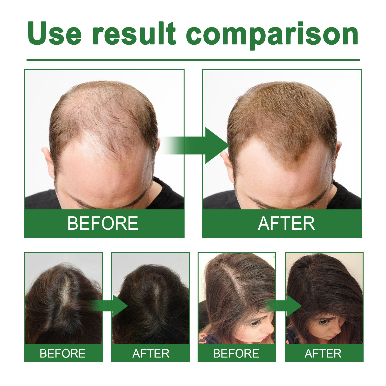 Rosemary Spray for Hair Nouris - Hair Care For Hair Growth 리뷰 및 가격