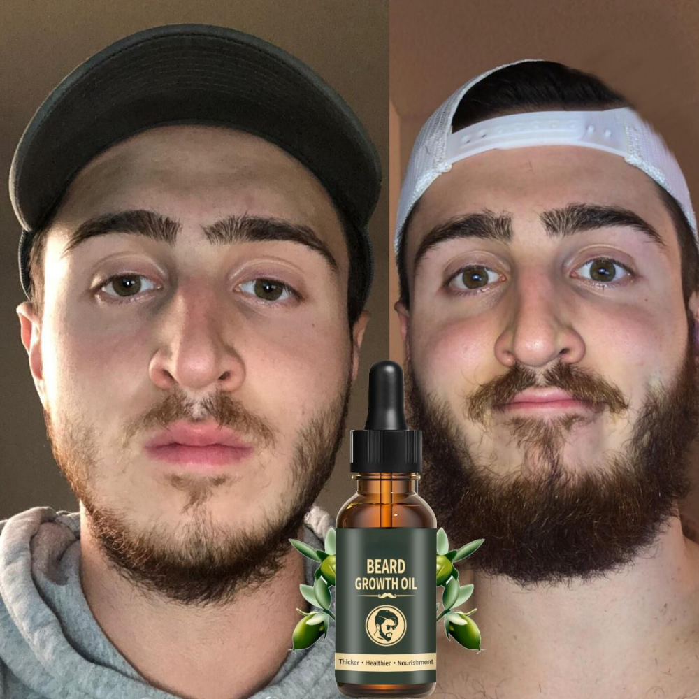 Fast Beard Growth Oil Beard Oi - Caffeine Hair Serum 리뷰 및 가격