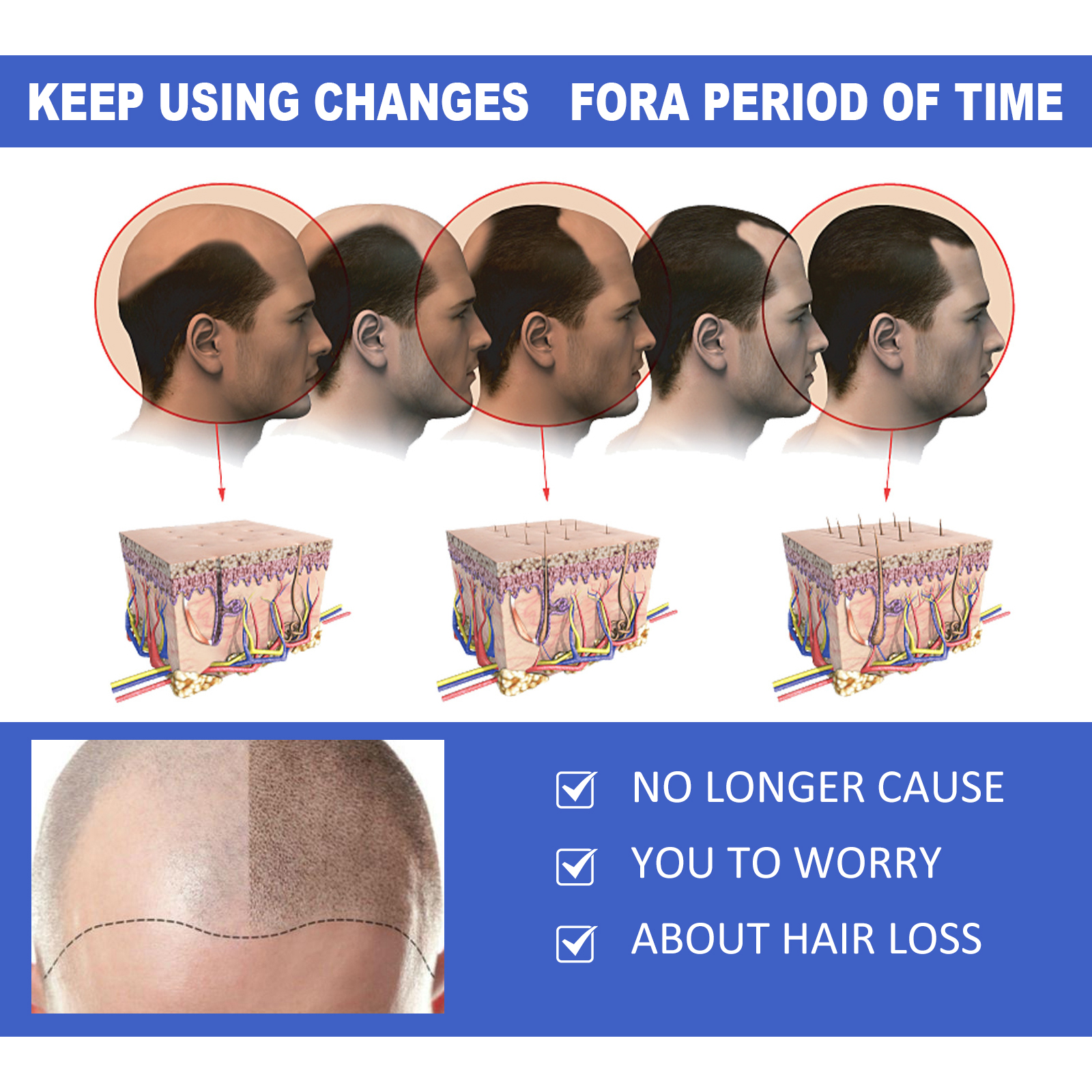 EELHOE Ginger Hair Care Serum  - Hair Care For Hair Fall 리뷰 및 가격
