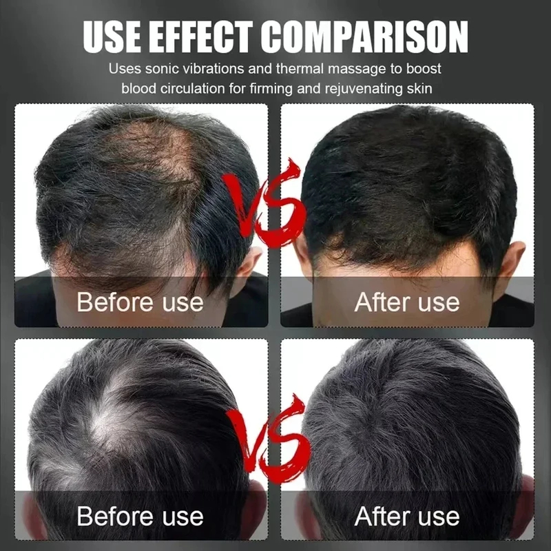 660nm 850nm Red Light Infrared - Hair Care For Hair Growth 리뷰 및 가격